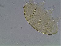 Echiniscus duboisi image