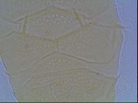 Echiniscus duboisi image