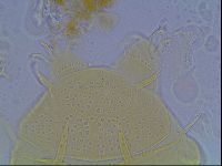 Echiniscus duboisi image