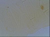 Echiniscus duboisi image