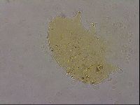 Echiniscus duboisi image