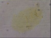Echiniscus duboisi image