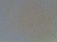 Echiniscus duboisi image