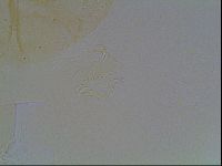 Echiniscus duboisi image