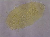 Echiniscus duboisi image
