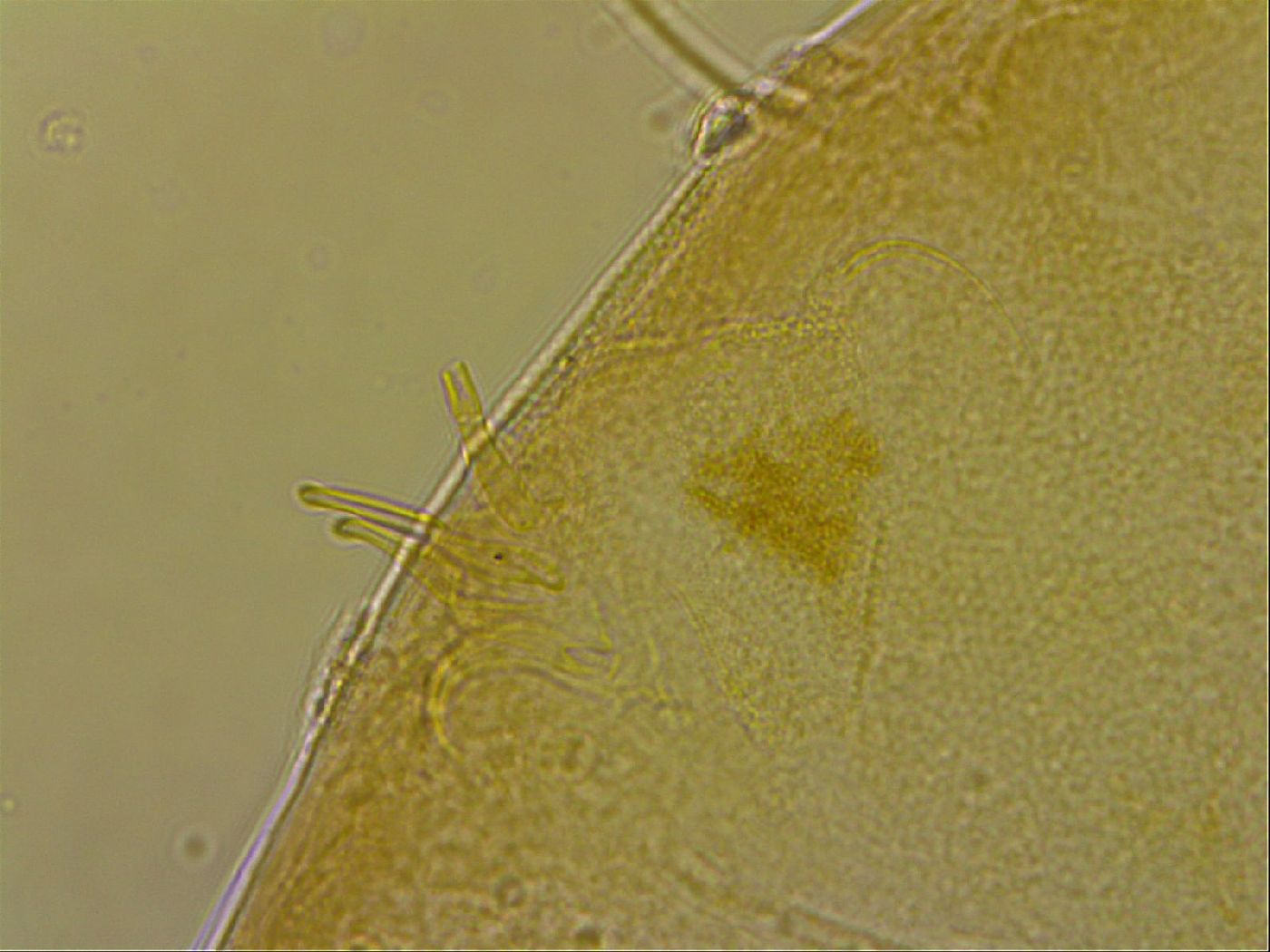 Echiniscus egnatiae image