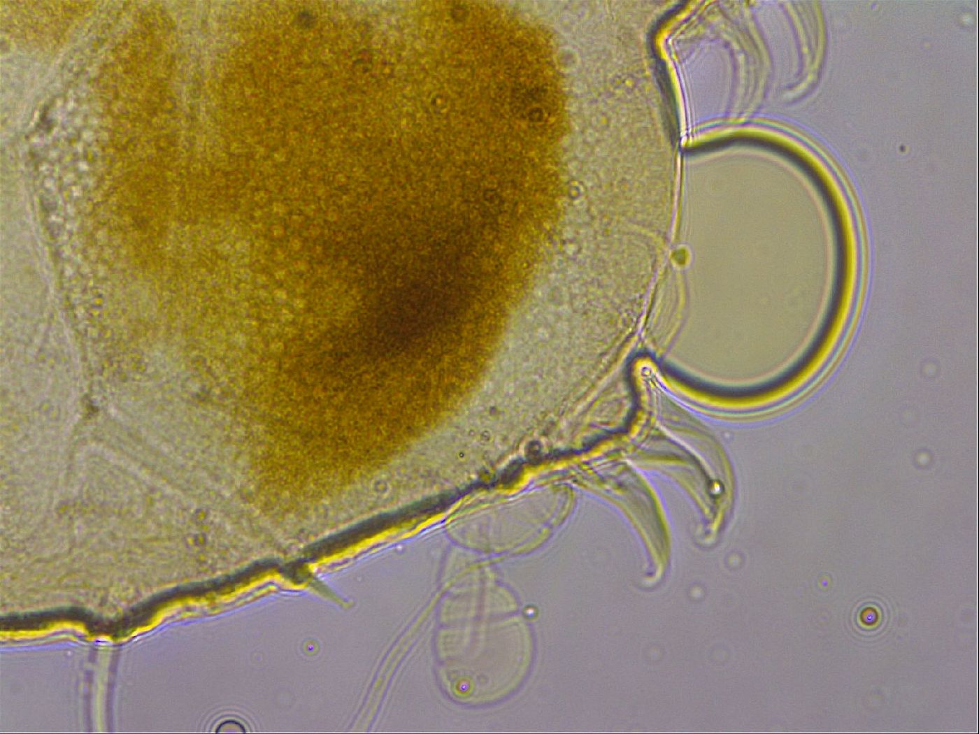 Echiniscus granulatus image