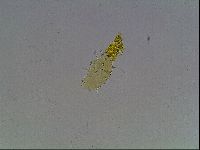 Echiniscus heterospinosus image