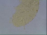 Echiniscus heterospinosus image
