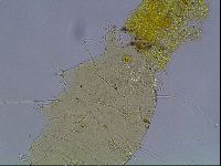 Echiniscus heterospinosus image