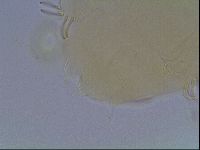 Echiniscus heterospinosus image