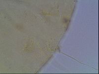 Echiniscus heterospinosus image