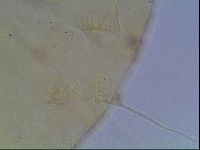 Echiniscus heterospinosus image
