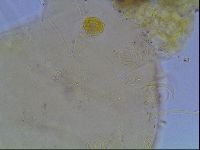Echiniscus heterospinosus image