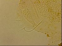 Echiniscus horningi image