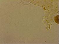 Echiniscus horningi image