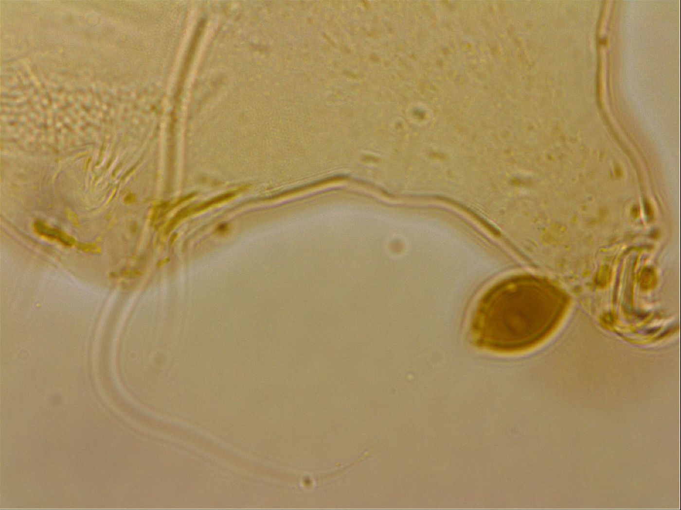 Echiniscus horningi image