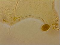 Echiniscus horningi image