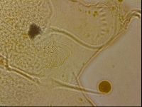 Echiniscus horningi image