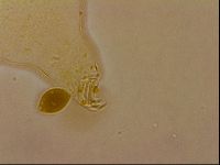 Echiniscus horningi image