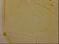 Echiniscus horningi image