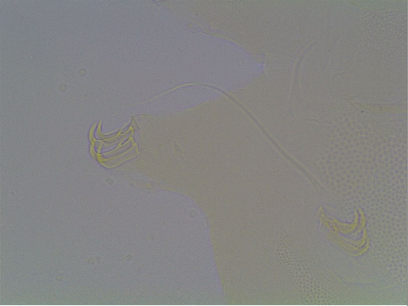 Echiniscus horningi image