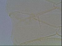 Echiniscus horningi image