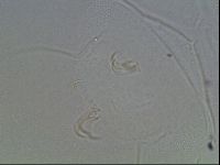 Echiniscus horningi image
