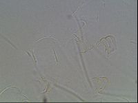 Echiniscus horningi image