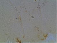 Echiniscus horningi image