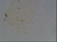 Echiniscus horningi image