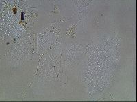 Echiniscus horningi image
