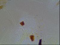 Echiniscus horningi image