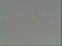 Echiniscus horningi image