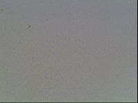 Echiniscus horningi image