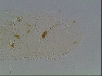 Echiniscus knowltoni image