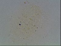 Echiniscus knowltoni image