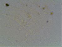 Echiniscus knowltoni image