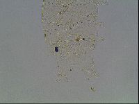 Echiniscus knowltoni image