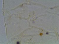 Echiniscus knowltoni image