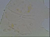 Echiniscus knowltoni image