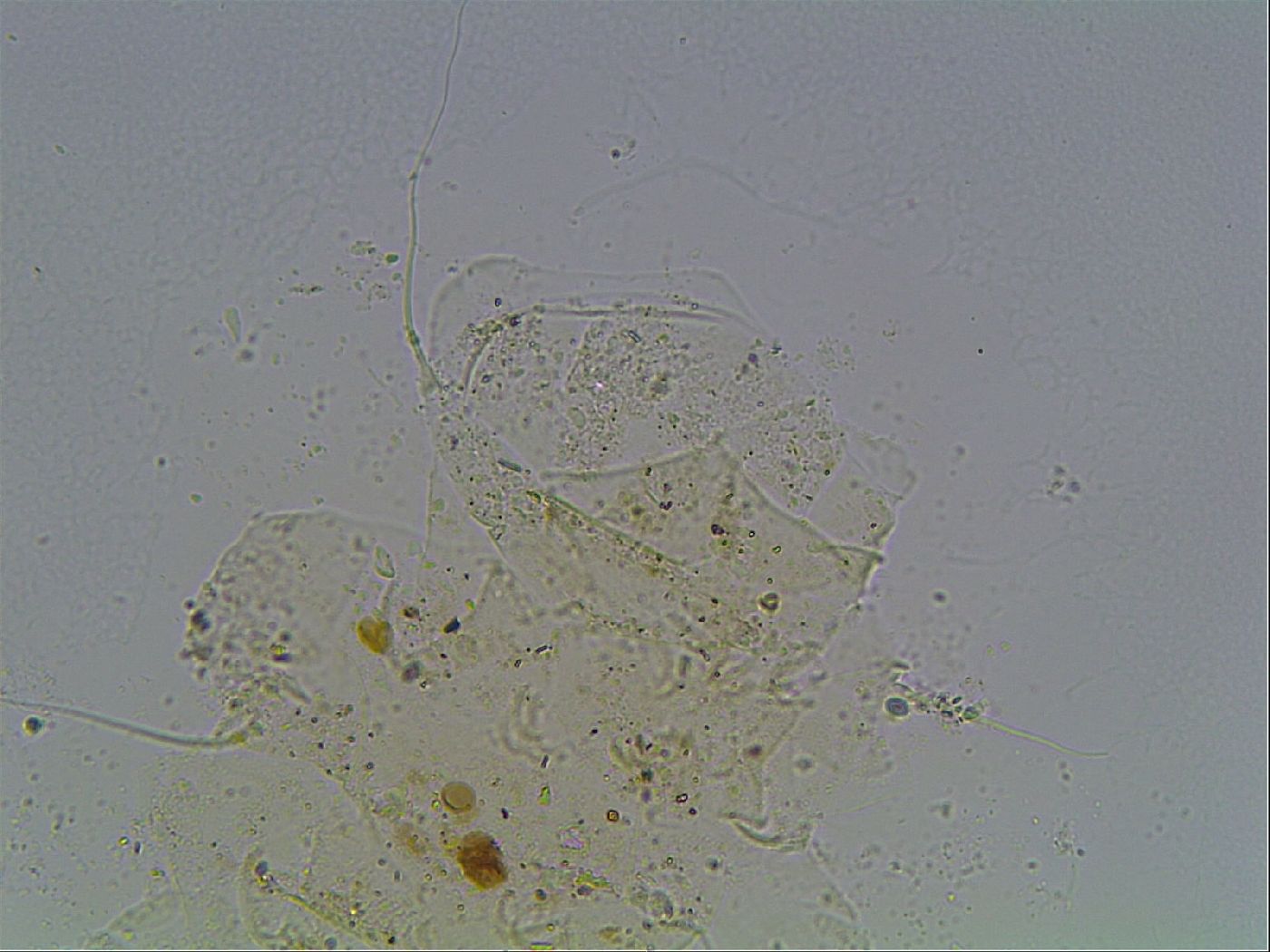 Echiniscus knowltoni image