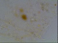Echiniscus knowltoni image