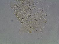 Echiniscus knowltoni image