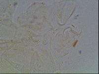 Echiniscus knowltoni image