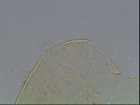 Echiniscus knowltoni image