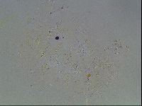 Echiniscus knowltoni image