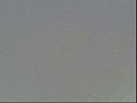 Echiniscus knowltoni image