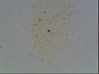 Echiniscus knowltoni image