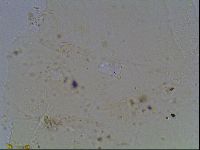 Echiniscus knowltoni image